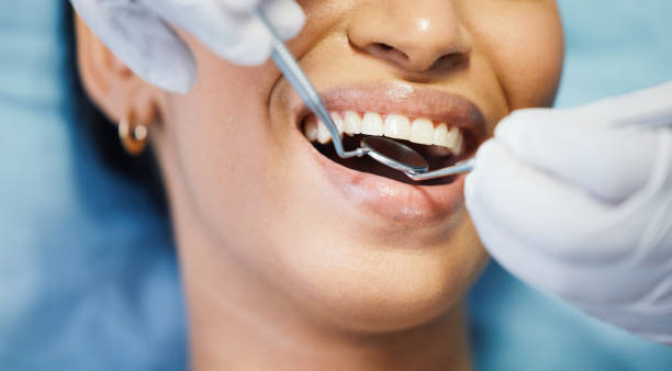 Best Emergency Denture Repair in Bay Shore, NY